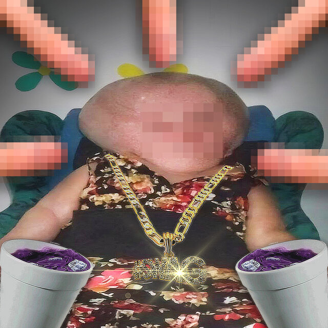 ГИДРОЦЕФАЛЬНЫЙ SWAG