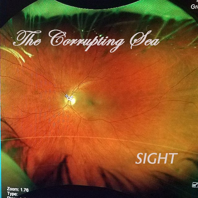 Sight