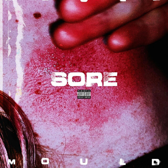 Sore