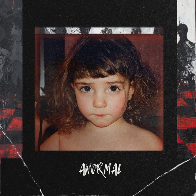 Anormal