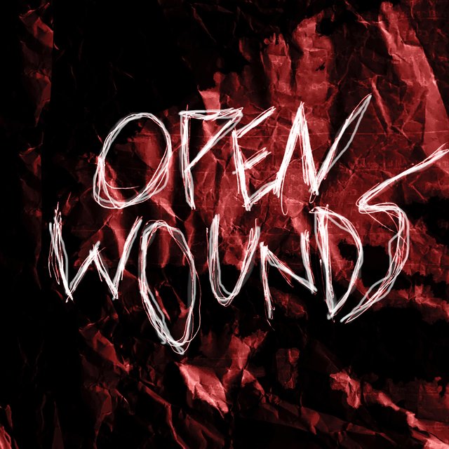 Open Wounds