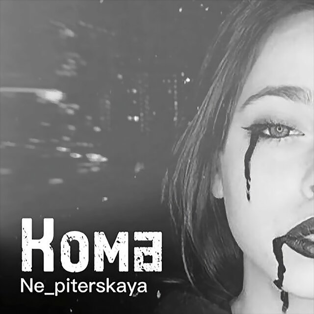 Кома