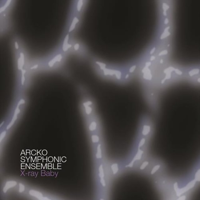 X-ray Baby