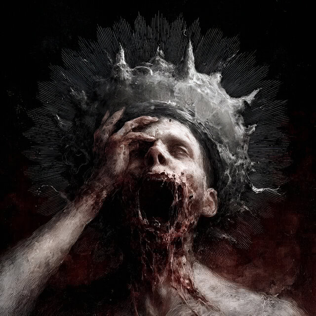 Skull Fradcture