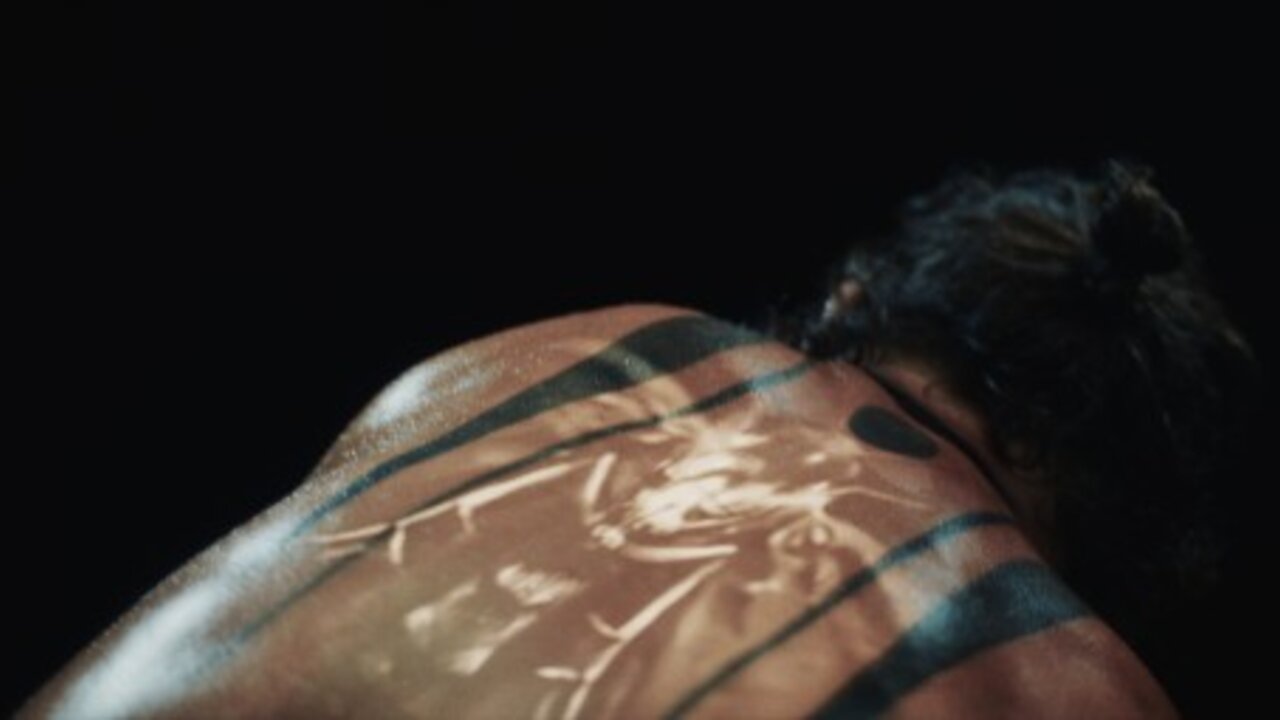 Scars