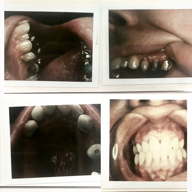 Taking Teeth: Volume 2