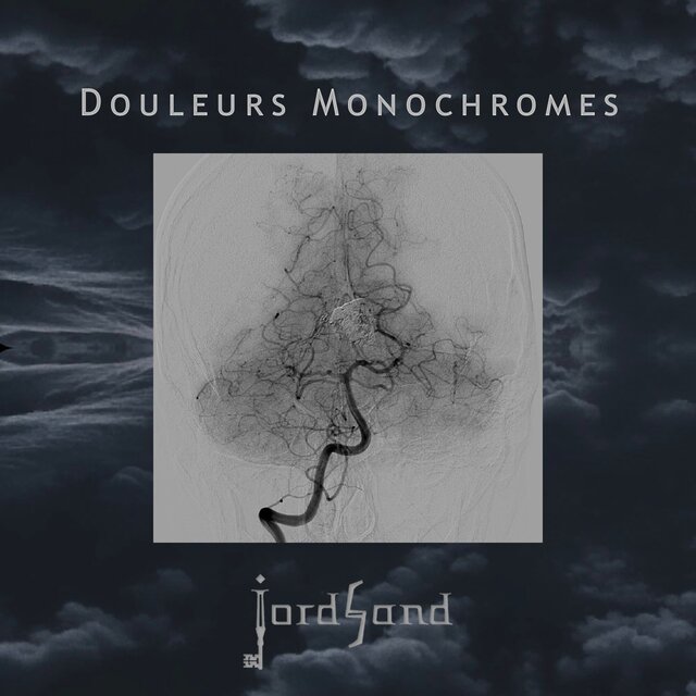 Douleurs monochromes