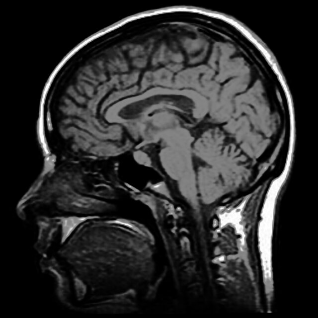My mind