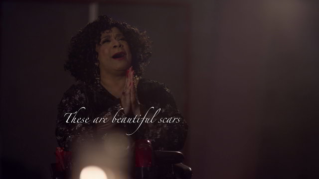 Beautiful Scars (Lyric Video)