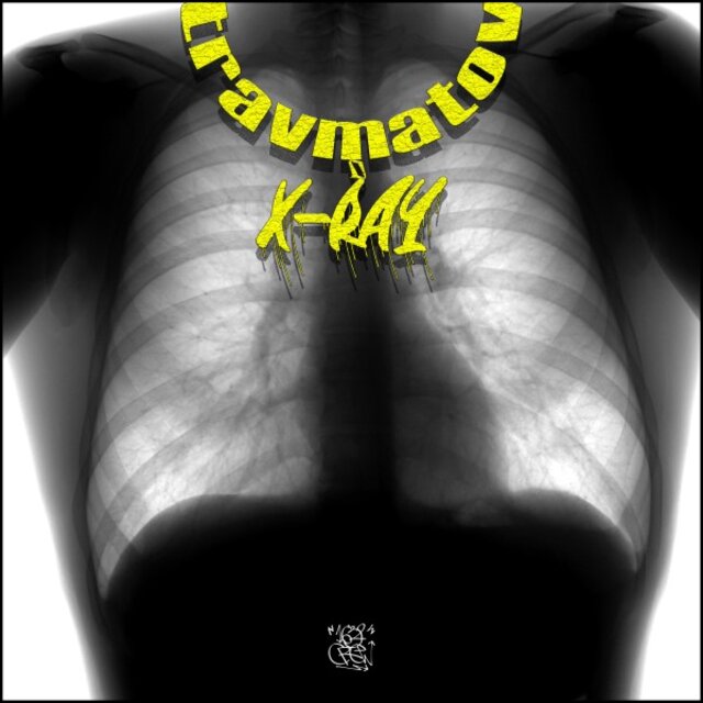 X-Ray