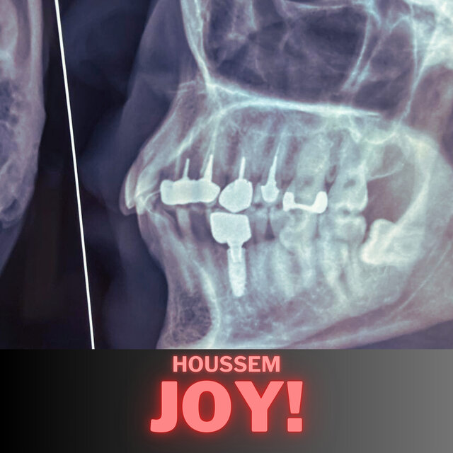 Joy! - EP