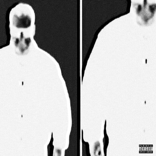 Bugatti & Benz (feat. killdummies)