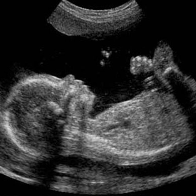 Womb Sounds - White Noise - Loopable with No Fade - Soothing Sounds