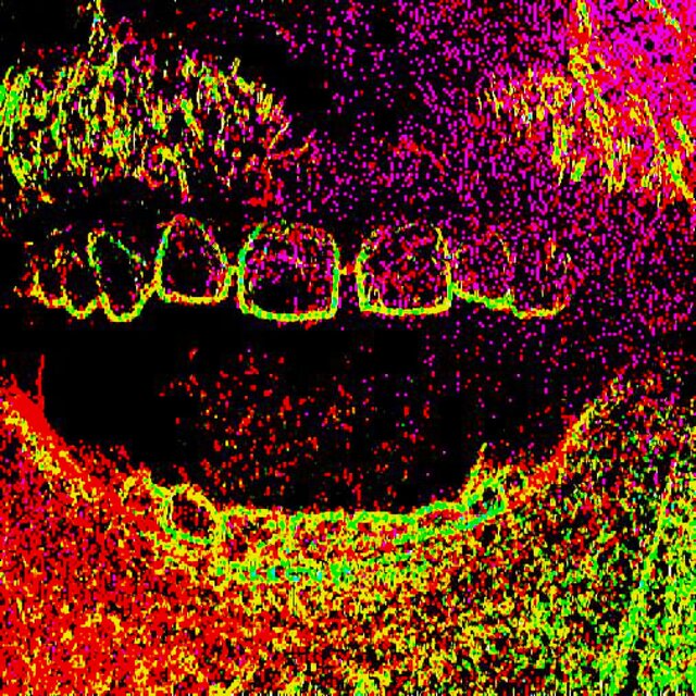 TEETHZ