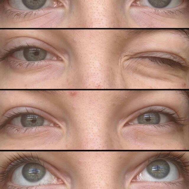 Blue Eyes!