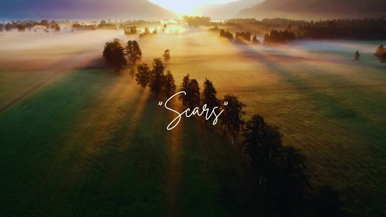 Scars