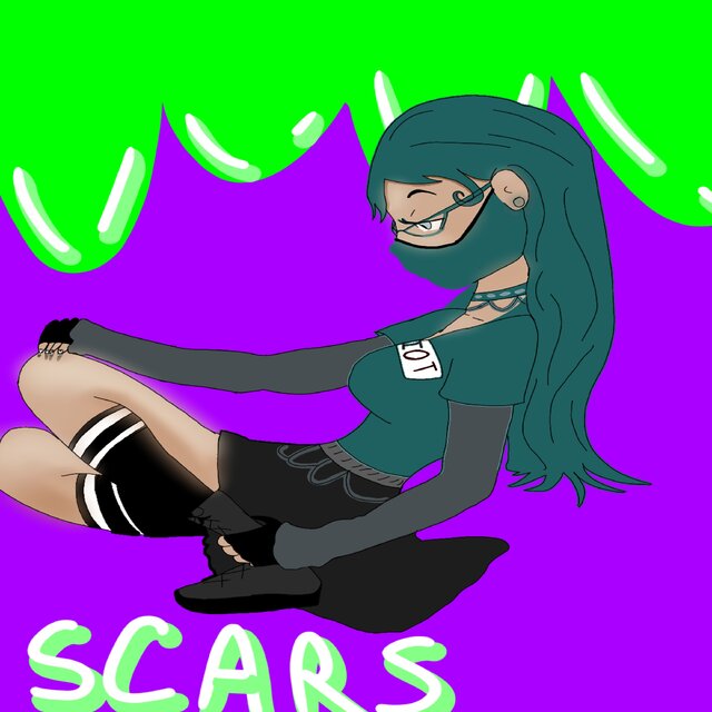 Scars