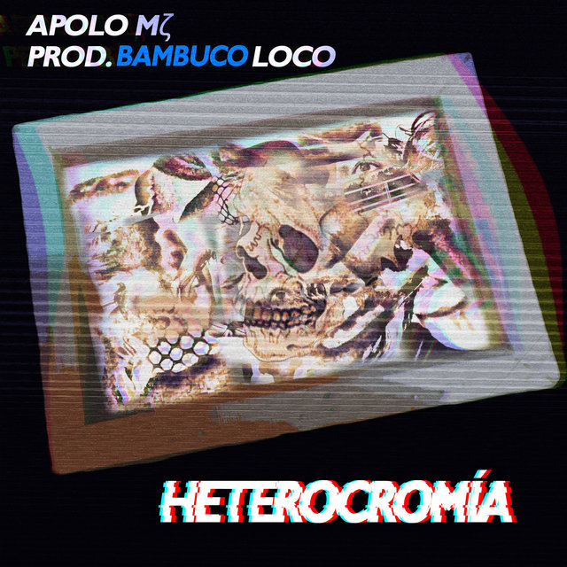 Heterocromía