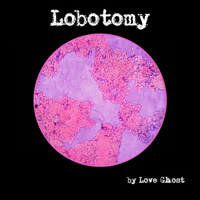 Lobotomy