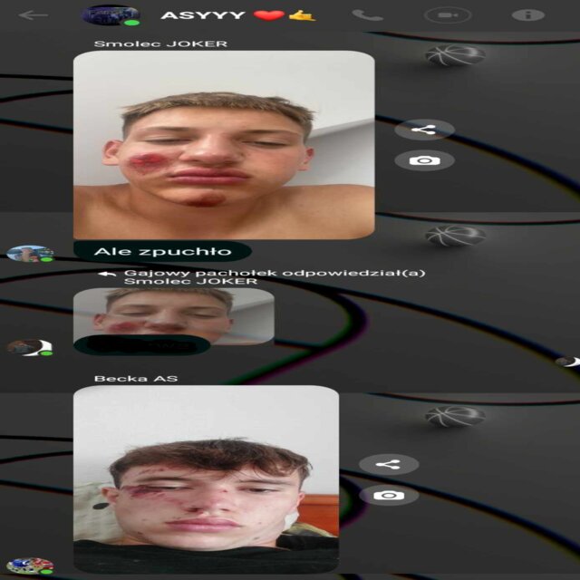 Dziary na twarzy