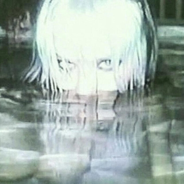 X Vision