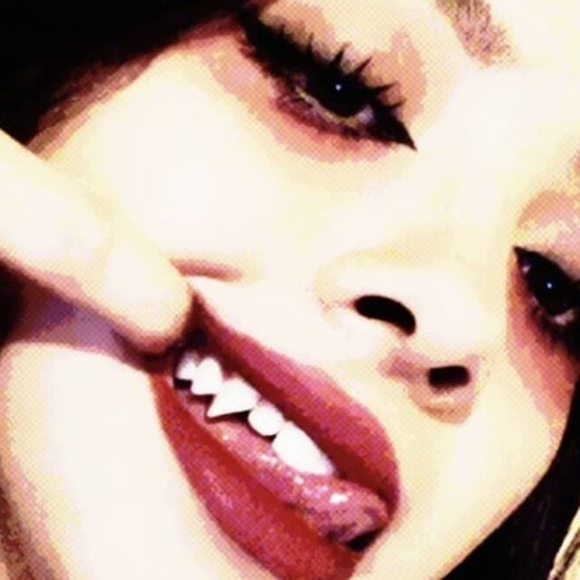 Labios