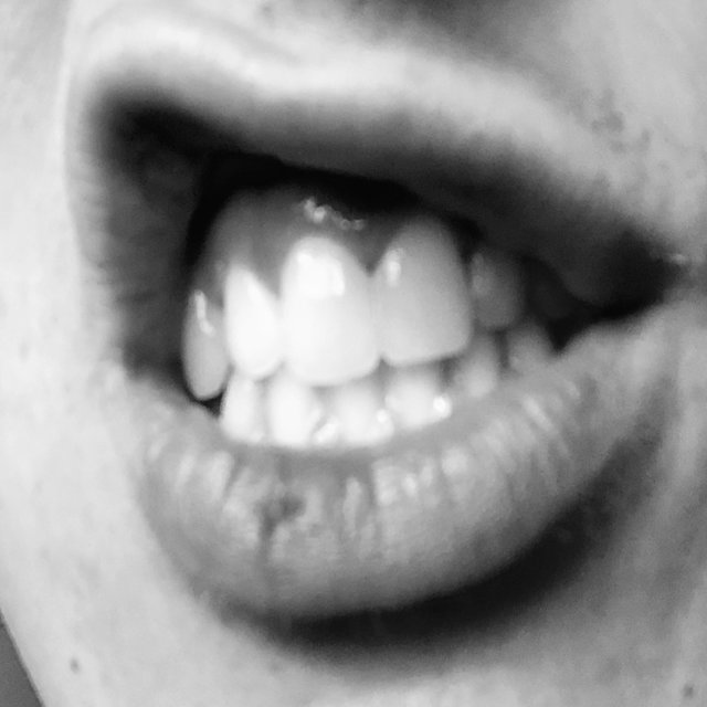 Cut Lip by Dr0ppa on TIDAL