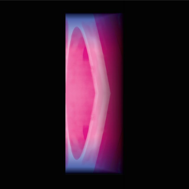 Bi