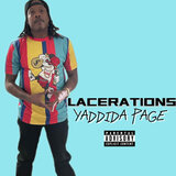 Lacerations