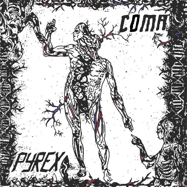 Coma
