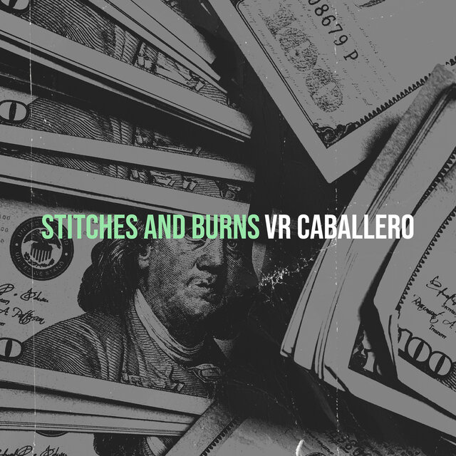 Stitches and Burns