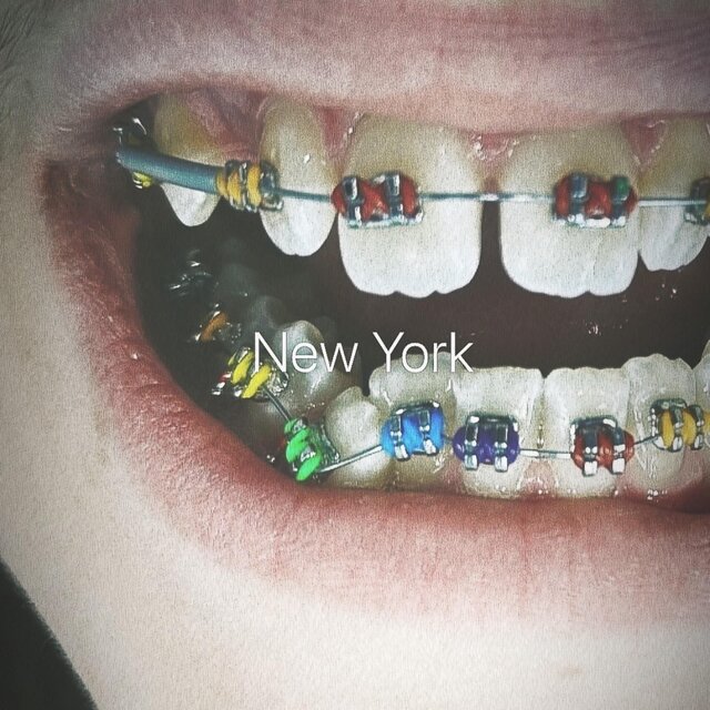 BraceFace