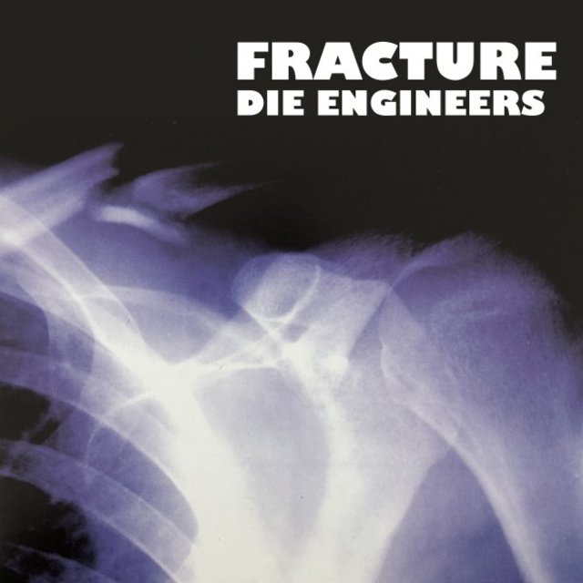 Fracture