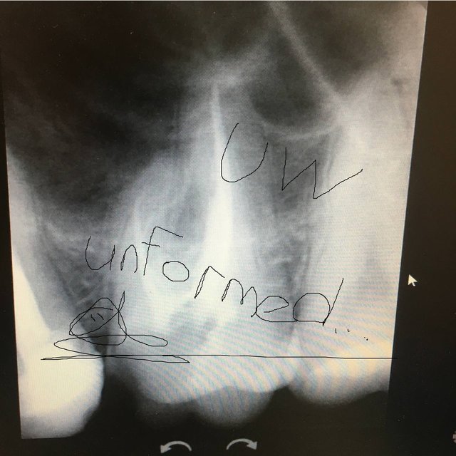 Unformed