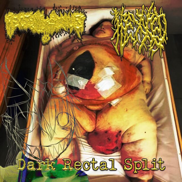 Dark Rectal Split
