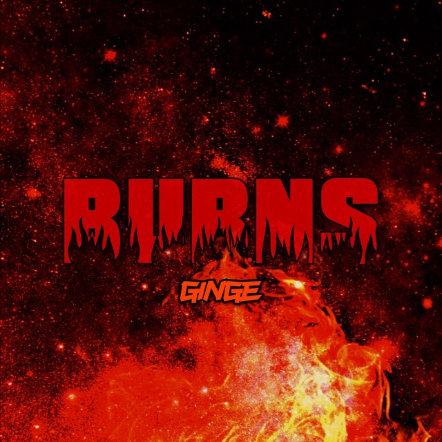 Burns