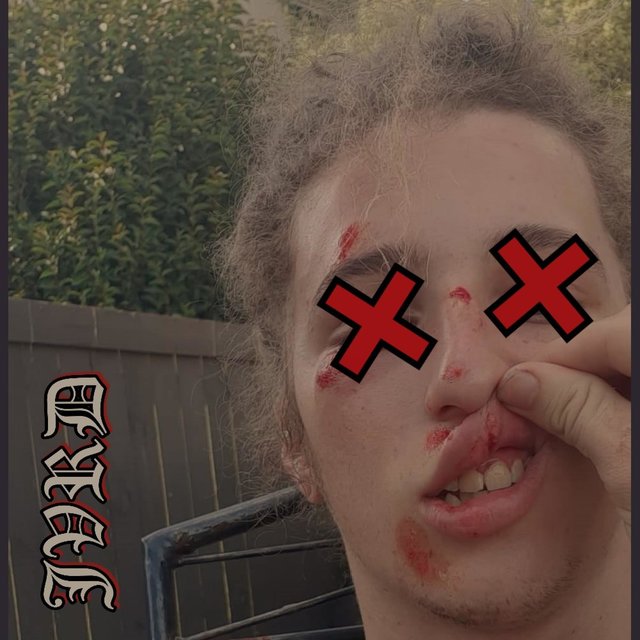 BLXXD