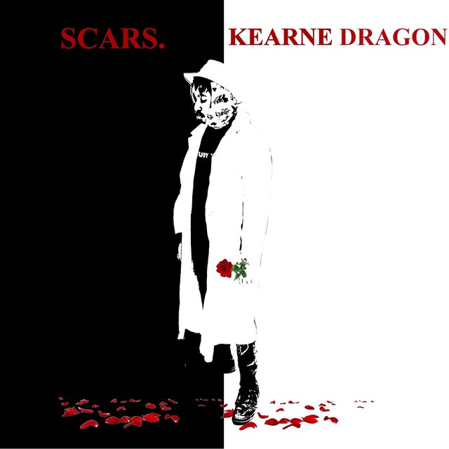 Scars