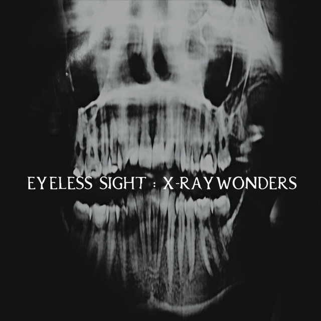 X-Ray Wonders