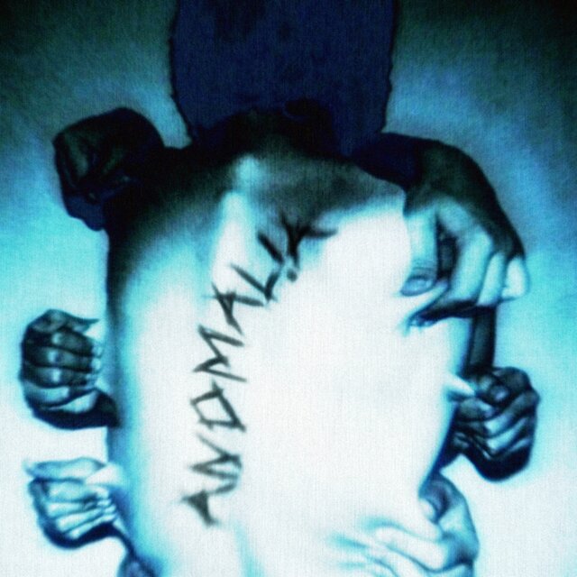 ANOMAL!A