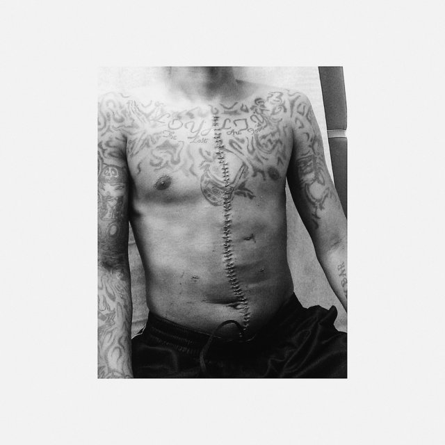 58 Staples