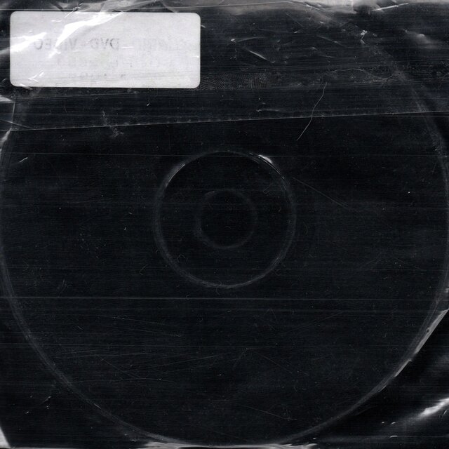 CD (Circular Distraction)