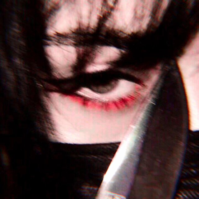 Scars