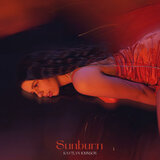 Sunburn