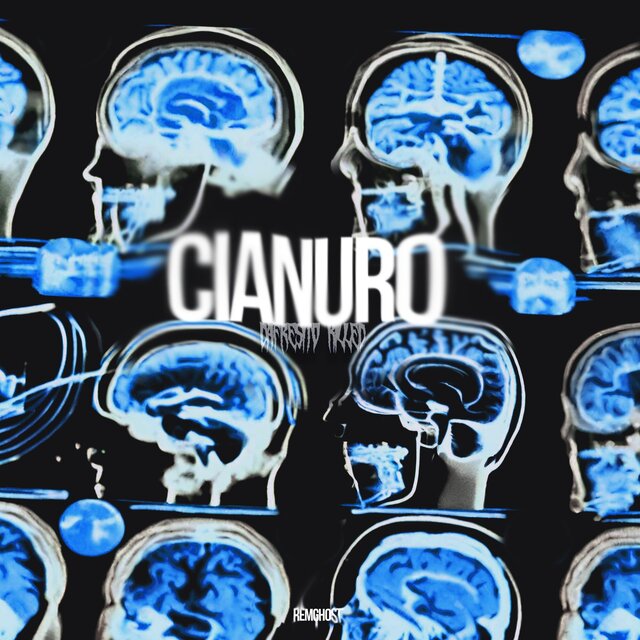 Cianuro