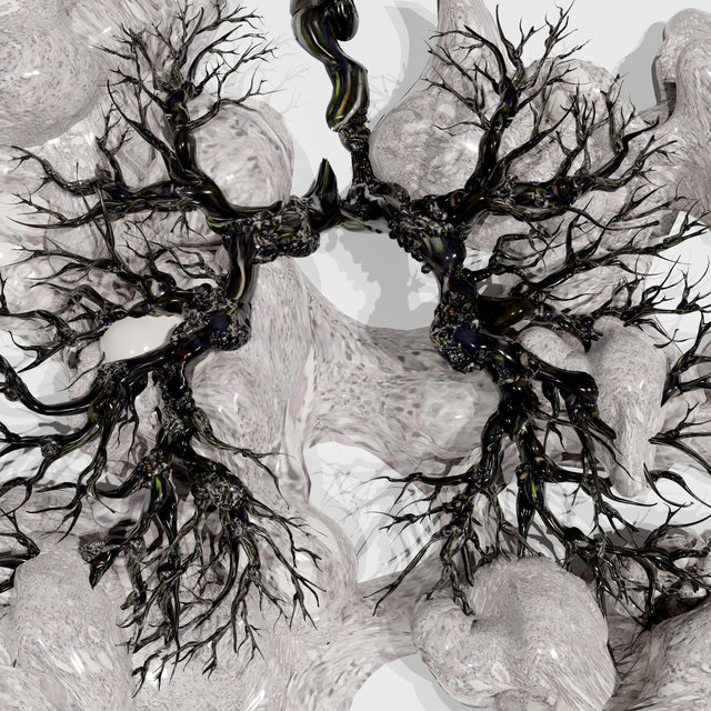Sarcoidosis