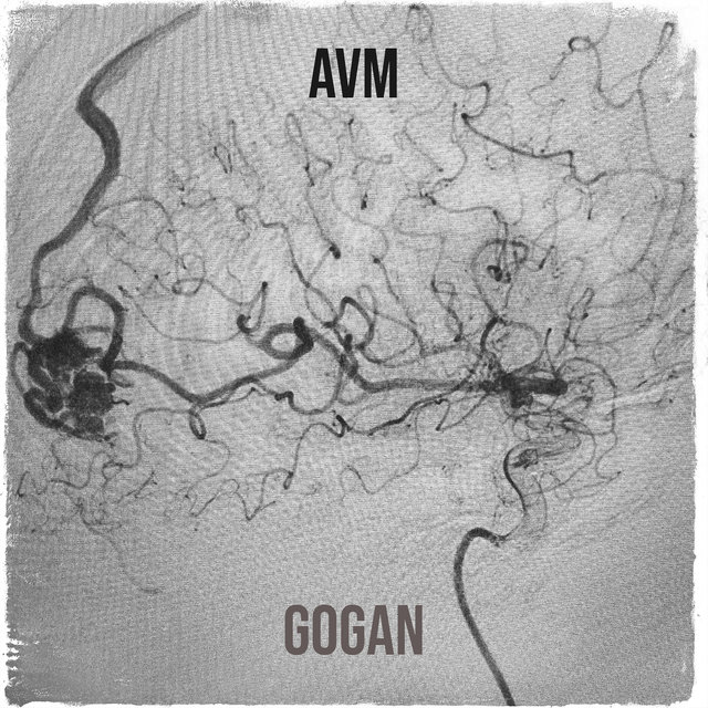 Avm