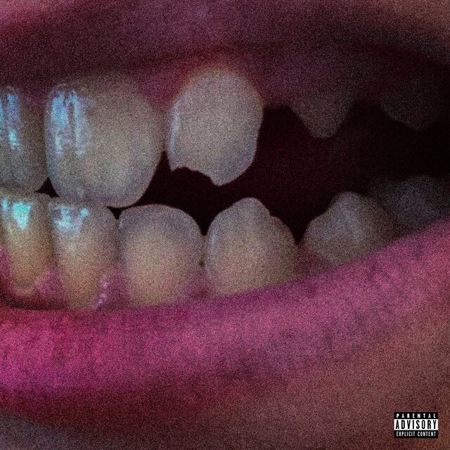 TOOTHACHE
