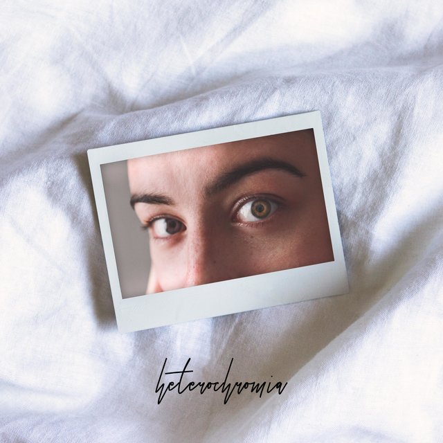 Heterochromia