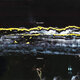 Cover art for album Pugnello by Gilla Band